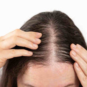 Caída del cabello y cada vez menos pelo en la cabeza