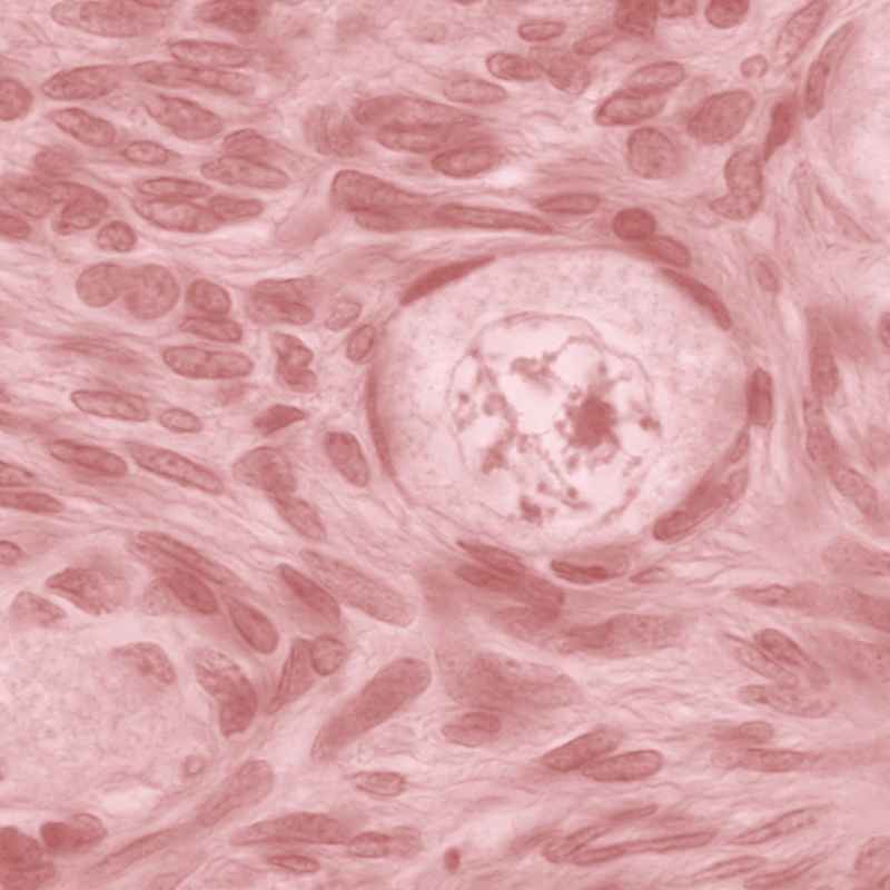 METABOLISMO DE ESTEROIDES