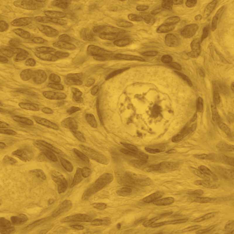 METABOLISMO DE ESTEROIDES